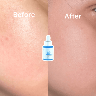 Barrier Boost Serum